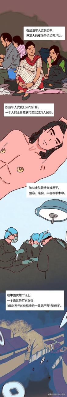 現(xiàn)在—個腎值多少錢插圖2 現(xiàn)在—個腎值多少錢插圖2